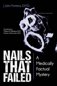 portada Nails That Failed: A Medically Factual Mystery (en Inglés)