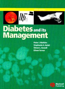 portada diabetes and its management (en Inglés)