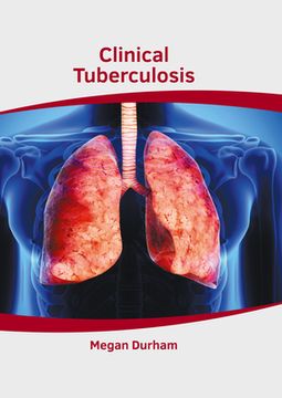 portada Clinical Tuberculosis (in English)