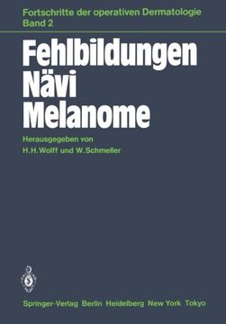 portada Fehlbildungen Nävi Melanome (Fortschritte der operativen und onkologischen Dermatologie) (German Edition)