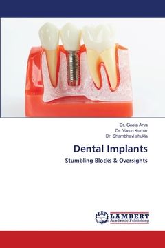 portada Dental Implants (en Inglés)