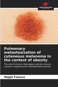 portada Pulmonary metastasization of cutaneous melanoma in the context of obesity