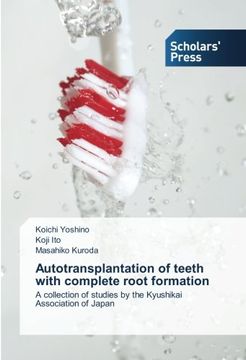 portada Autotransplantation of teeth with complete root formation: A collection of studies by the Kyushikai Association of Japan
