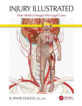 portada Injury Illustrated: How Medical Images win Legal Cases (en Inglés)