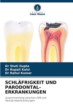 portada Schläfrigkeit Und Parodontal- Erkrankungen (en Alemán)