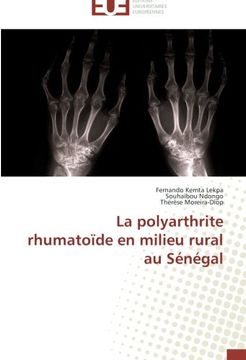 portada La polyarthrite rhumatoïde en milieu rural au Sénégal