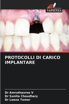 portada Protocolli Di Carico Implantare (in Italian)