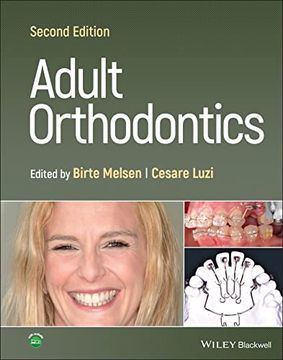 portada Adult Orthodontics (en Inglés)