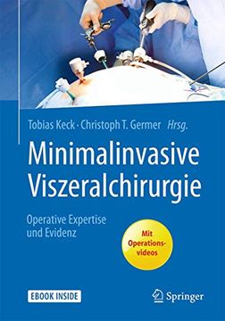 portada Minimalinvasive Viszeralchirurgie: Operative Expertise und Evidenz (en Alemán)