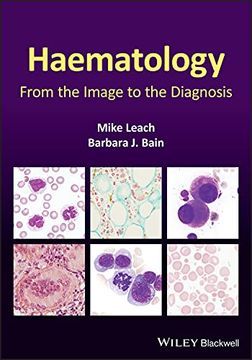 portada Haematology: From the Image to the Diagnosis (in English)