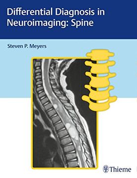 portada Differential Diagnosis in Neuroimaging: Spine