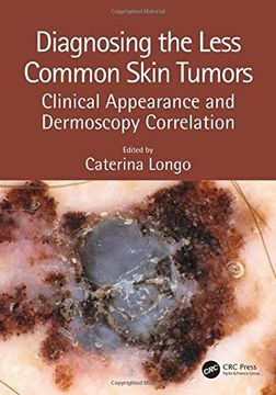 portada Diagnosing the Less Common Skin Tumors: Clinical Appearance and Dermoscopy Correlation (en Inglés)