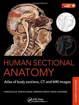 portada Human Sectional Anatomy: Atlas of Body Sections, CT and MRI Images, Fourth Edition