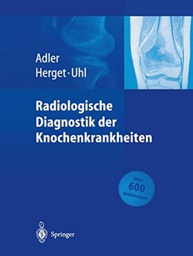portada Radiologische Diagnostik der Knochenkrankheiten (en Alemán)