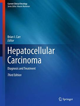 portada Hepatocellular Carcinoma: Diagnosis and Treatment (en Inglés)