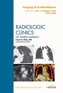 portada Imaging of Incidentalomas, an Issue of Radiologic Clinics of North America: Volume 49-2 (in English)