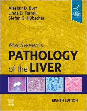 portada Macsween's Pathology of the Liver (en Inglés)