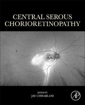 portada Central Serous Chorioretinopathy (en Inglés)