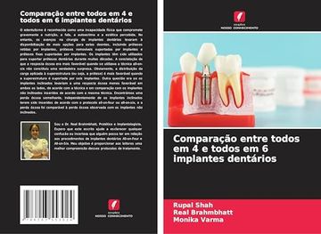 Comparação Entre Todos em 4 e Todos em 6 Implantes Dentários (en Portugués)