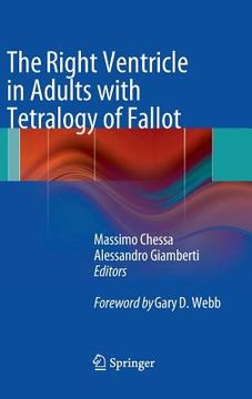 portada the right ventricle in adults with tetralogy of fallot