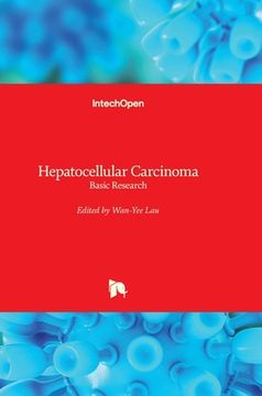 portada Hepatocellular Carcinoma: Basic Research (en Inglés)