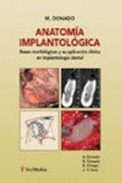 portada Anatomia Implantologica (in Spanish)
