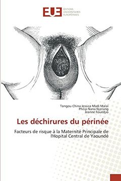 portada Les déchirures du périnée: Facteurs de risque à la Maternité Principale de l'Hopital Central de Yaoundé (Omn.Univ.Europ.) (French Edition)
