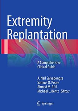 portada Extremity Replantation: A Comprehensive Clinical Guide (in English)