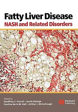 portada fatty liver disease: nash and related disorders (en Inglés)
