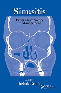portada Sinusitis: From Microbiology to Management: 35 (Infectious Disease and Therapy) (en Inglés)