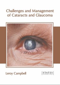portada Challenges and Management of Cataracts and Glaucoma (en Inglés)