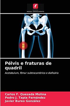 portada Pélvis e Fraturas de Quadril: Acetabulum, Fêmur Subtrocantérico e Diafisário (en Portugués)