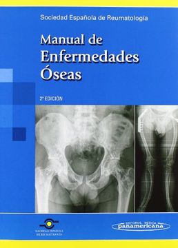 portada Manual de Enfermedades Oseas (in Spanish)