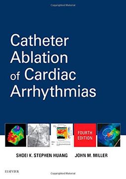 portada Catheter Ablation of Cardiac Arrhythmias (en Inglés)