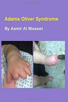 portada Adams Oliver Syndrome: Clinical Genetics (en Inglés)