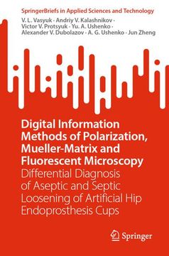 portada Digital Information Methods of Polarization, Mueller-Matrix and Fluorescent Microscopy: Differential Diagnosis of Aseptic and Septic Loosening of Arti (en Inglés)