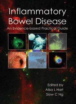 Inflammatory Bowel Disease: An Evidence-Based Practical Guide (en Inglés)