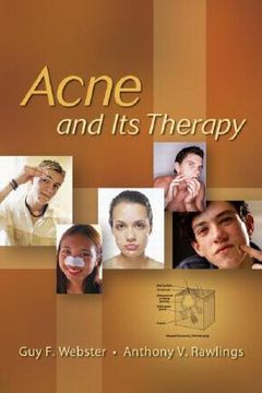 portada acne and its therapy