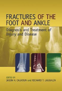 portada fractures of the foot and ankle: diagnosis and treatment of injury and disease (en Inglés)