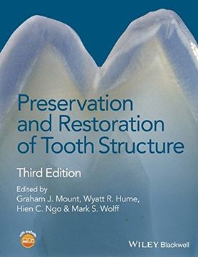 portada Preservation and Restoration of Tooth Structure (en Inglés)