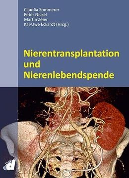 portada Nierentransplantation und Nierenlebendspende (en Alemán)