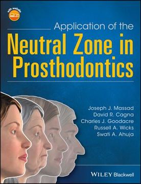 Application of the Neutral Zone in Prosthodontics (en Inglés)