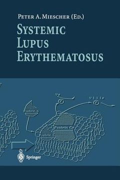 portada systemic lupus erythematosus (in English)