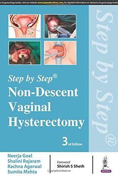 portada Step by Step: Non-Descent Vaginal Hysterectomy