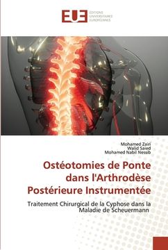 portada Ostéotomies de Ponte dans l'Arthrodèse Postérieure Instrumentée (en Francés)