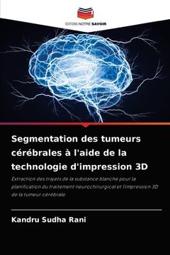 portada Segmentation des tumeurs cérébrales à l'aide de la technologie d'impression 3D (en Francés)