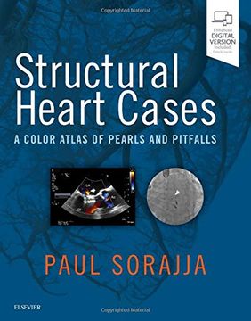 portada Structural Heart Cases. (A Color Atlas of Pearls and Pitfalls (en Inglés)