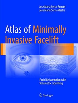 portada Atlas of Minimally Invasive Facelift: Facial Rejuvenation with Volumetric Lipofilling (in English)
