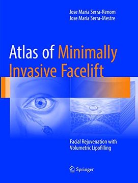 portada Atlas of Minimally Invasive Facelift: Facial Rejuvenation with Volumetric Lipofilling (en Inglés)