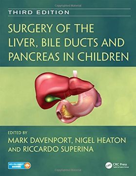 portada Surgery of the Liver, Bile Ducts and Pancreas in Children